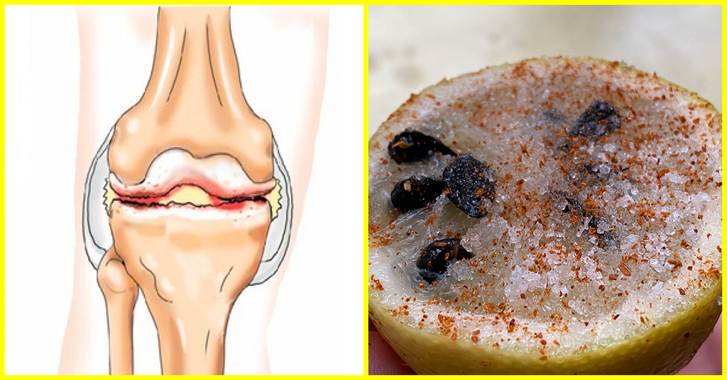 10 INGREDIENTES DE TU COCINA QUE PREVIENEN LA ARTRITIS